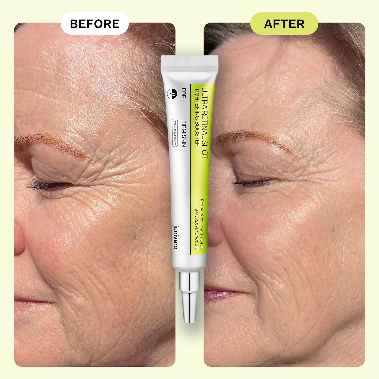 Junivera™ Ultra Retinal Shot + Tightening Booster