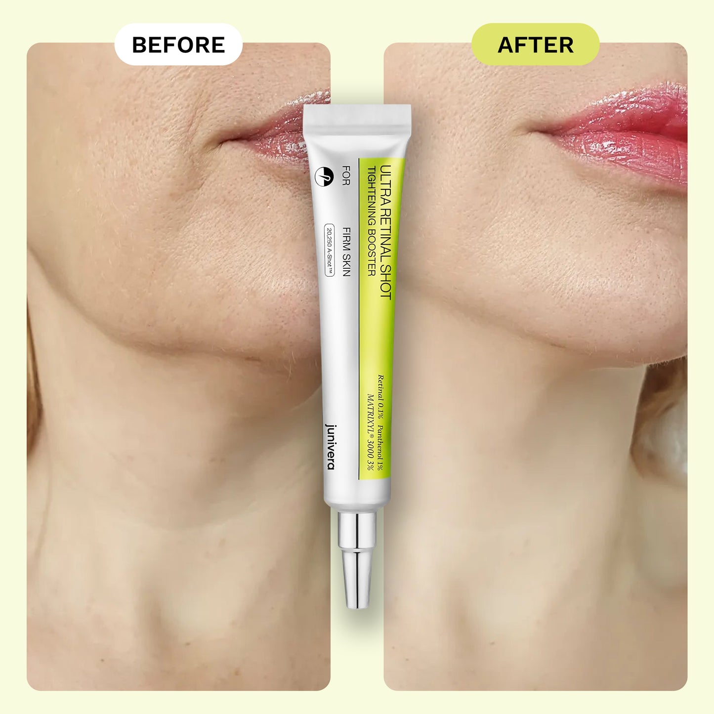 Junivera™ Ultra Retinal Shot + Tightening Booster
